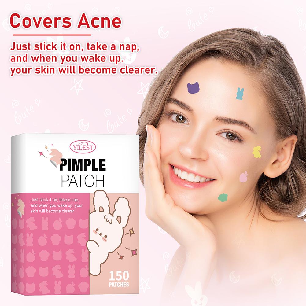 Acne Pimple Patch: Waterproof Blemish Remover Stickers